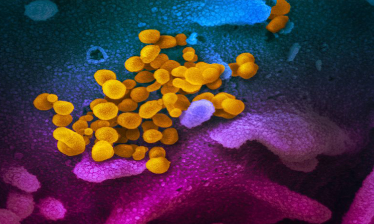 আনুষ্ঠানিক নাম পেয়েছে করোনাভাইরাস