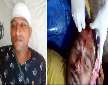 মহেশপুরে ভোট না দেওয়ার অভিযোগে নারীসহ ৬জন আহত