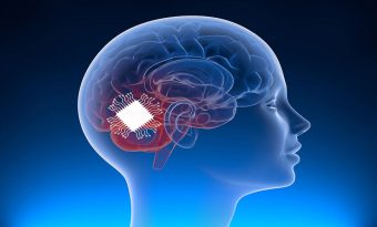 বাণিজ্যিকভাবে ব্রেইন চিপ ডিভাইসের অনুমোদন দিয়েছে চীন